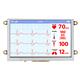Newhaven Display NHD-5.0-HDMI-N-RSXP